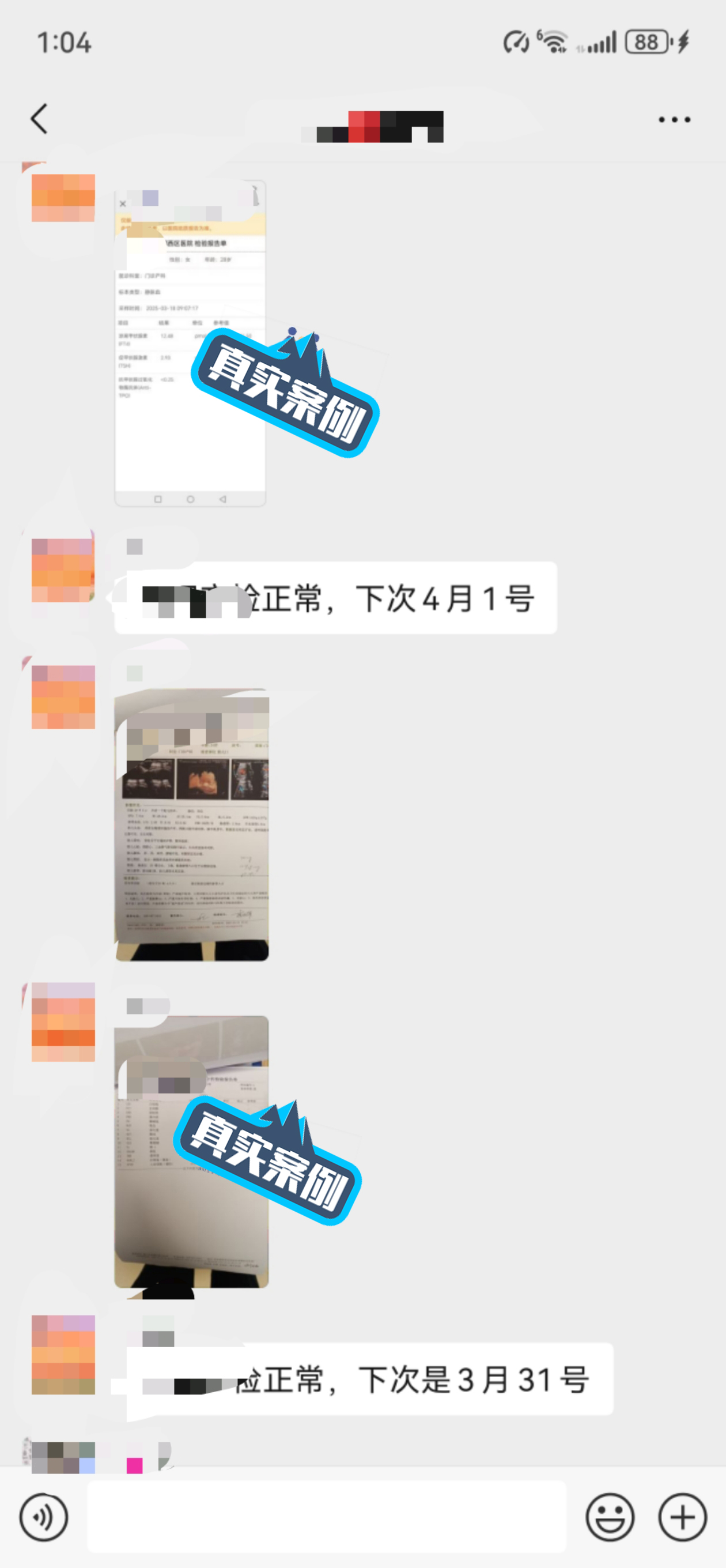 产检反馈更新,好孕定制抱娃无忧-第5张图片